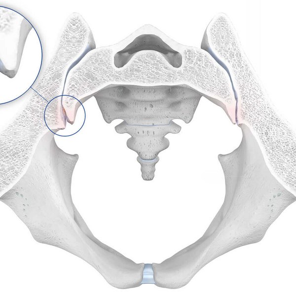 Illustration der Anatomie der Hüfte bei einer vorliegenden Spondylarthrose.